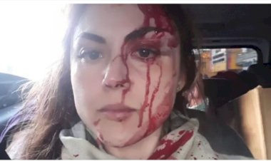 AGRESSOR DE PROCURADORA  ESPANCADA,TEM PRISÃO PREVENTIVA DECRETADA PELA JUSTIÇA SAIBA  MAIS DETALHES