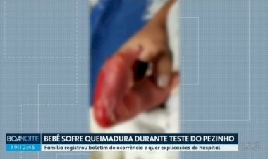 Hospital e Conselho de Enfermagem apuram caso de bebê que teria sofrido queimadura durante teste do pezinho